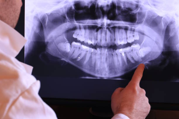Best Emergency Broken Tooth Repair in Bronte, TX