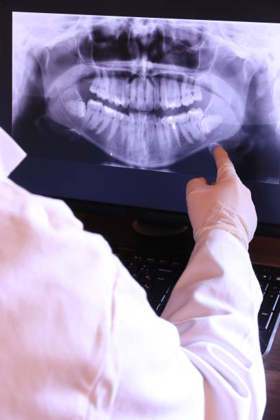 Best Pediatric Emergency Dentist in Bronte, TX